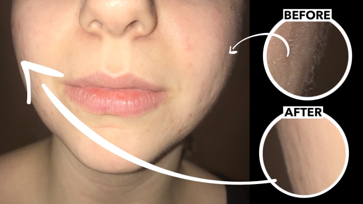 Finishing Touch Flawless Review Is This Facial Hair Remover Worth
