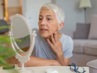 What is rosacea and what can you do for it?