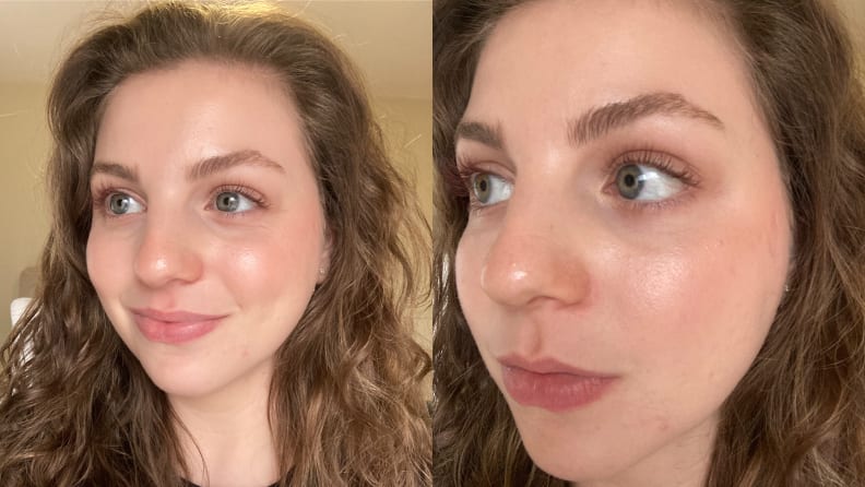 How Rare Beauty Tinted Moisturizer Works on Skin With Acne