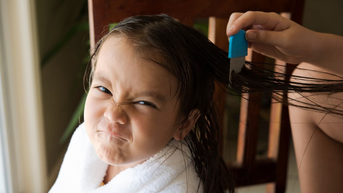 Expert tips for how to treat head lice - Reviewed