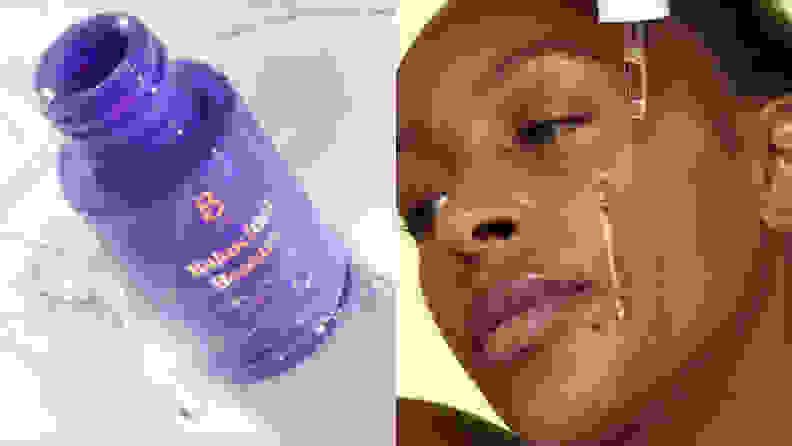 On the left: A purple oil bottle uncapped. On the right: A closeup on a person's face with drops of clear liquid on their face from a dropper.