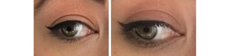 KVD