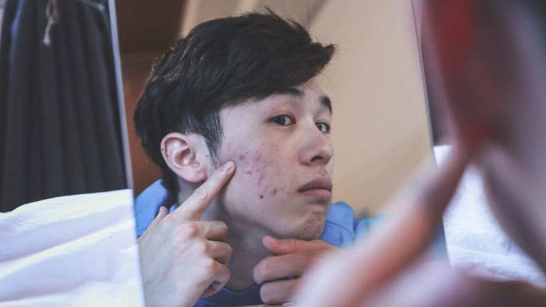 A person looking into a mirror and touching the acne on their cheek.