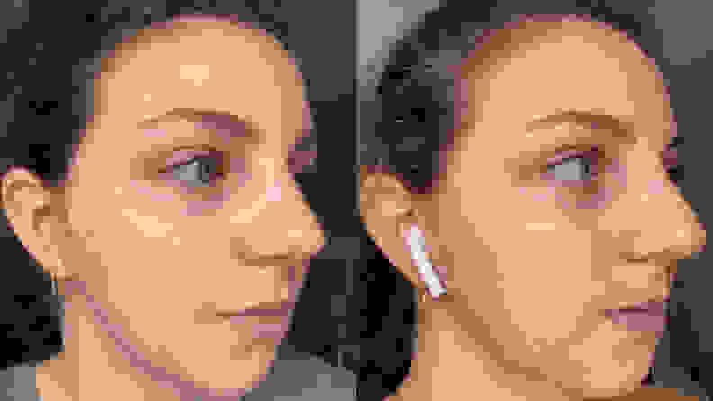 A side by side image of the right side of the author's face, showing more redness on the cheeks in the left image.