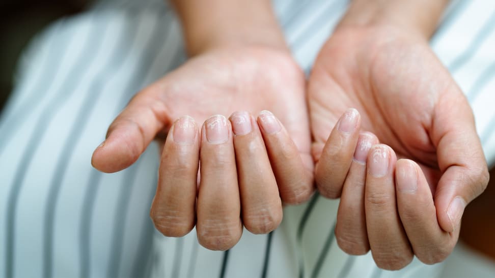 A person holding out their hands palm side up with their fingertips curled upward. The fingernails look dry.