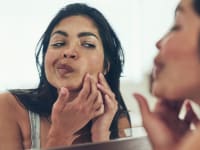 The truth about blackheads—and how to get rid of them