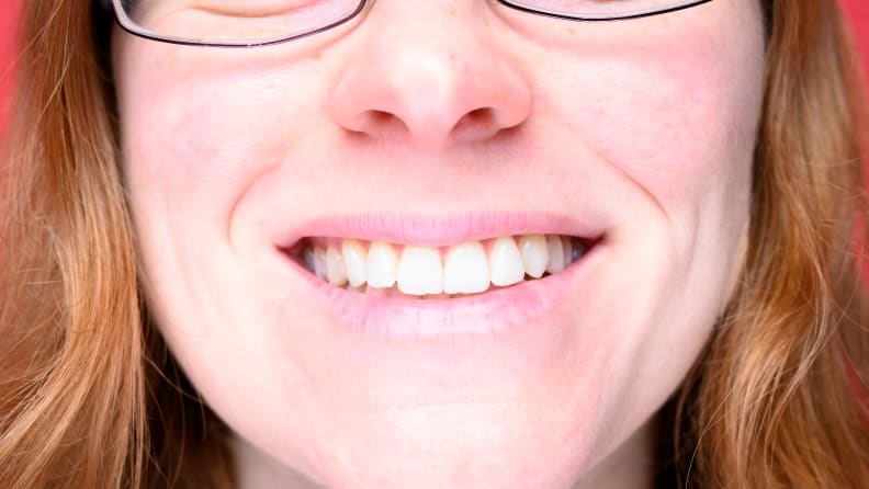 My teeth prior to brushing with baking soda.