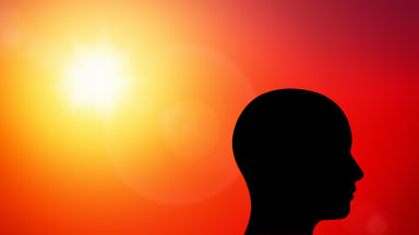 A bald head silhouette on a red background with a blazing sun