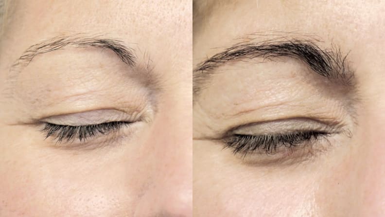 A woman before and after using the NeuBrow Brow Enhancing Serum.