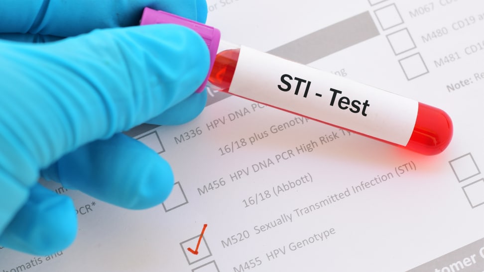 A vial labeled "STI-Test."