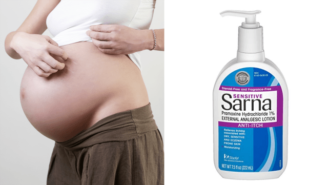 Sarna lotion