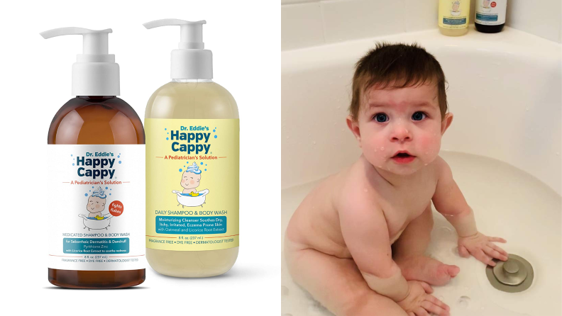 Invented by a pediatrician, this shampoo can help with cradle cap.