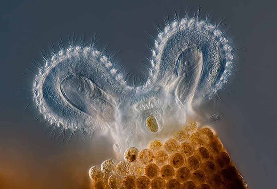 Microscopic image of a Rotifer Floscularia ringens feeding
