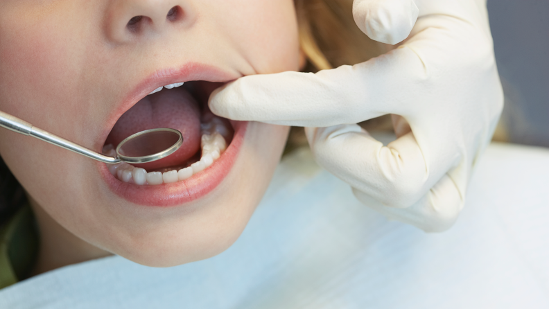 Child's teeth being examined at dentist