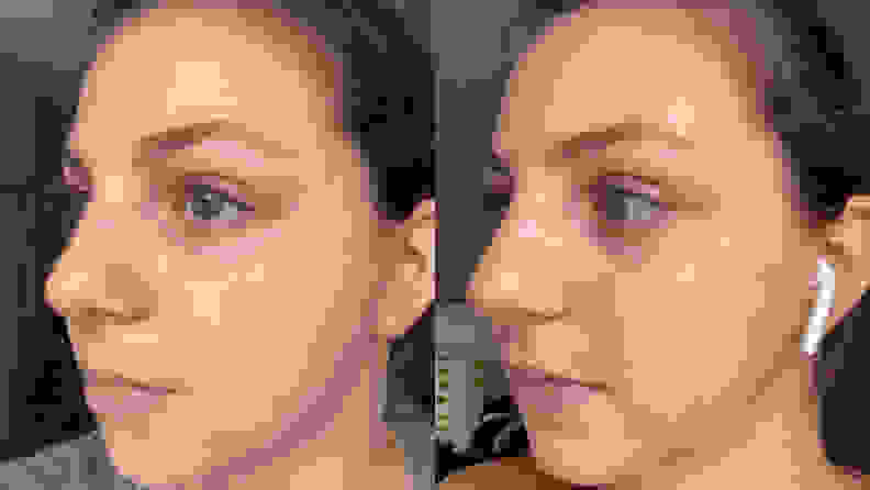 A side by side image of the left side of the author's face, showing more redness on the cheeks in the left image.
