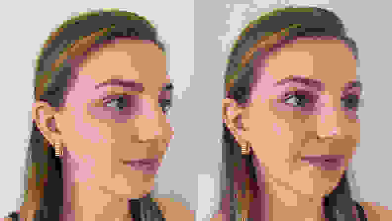 The right side of the author's face before (left) and after (right) applying the Wet n Wild Bare Focus Tinted Hydrator.