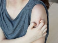 What is keratosis pilaris and what can you do for it?