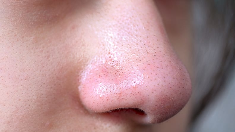 A closeup on a nose with blackheads and pores.