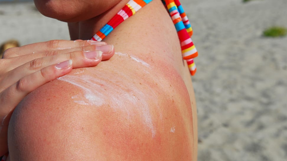 A closeup of a person's shoulder as they apply sunscreen lotion to it.