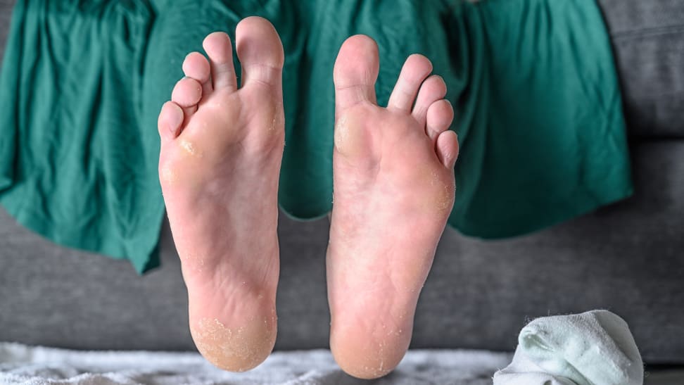 This Cult Favorite Foot Peel Made My Feet Look Disgusting Was It Worth It Reviewed