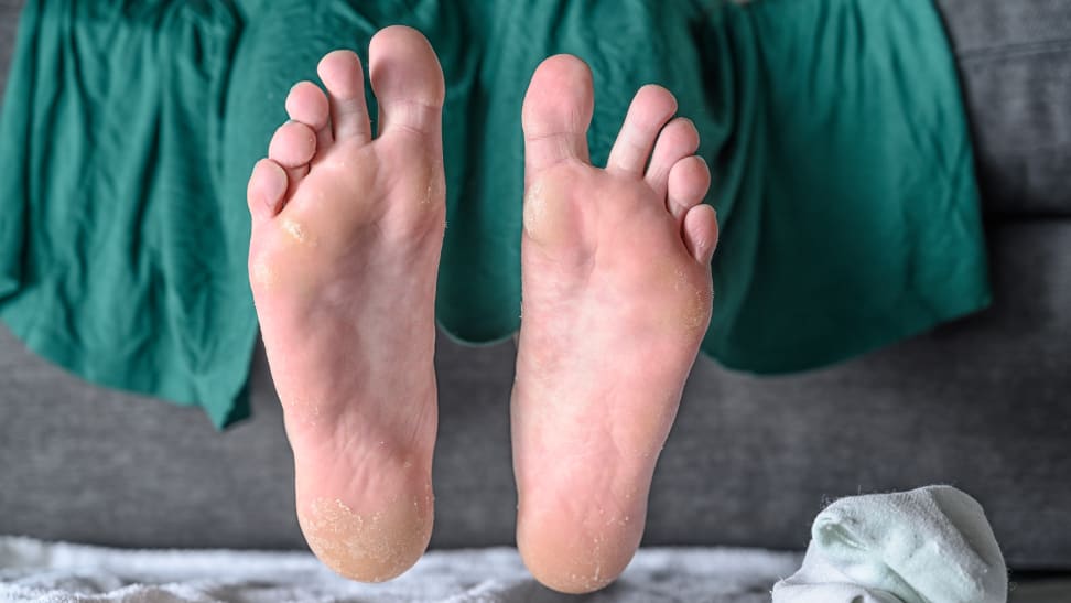 This cult-favorite foot peel made my feet look disgusting—was it worth it?  - Reviewed