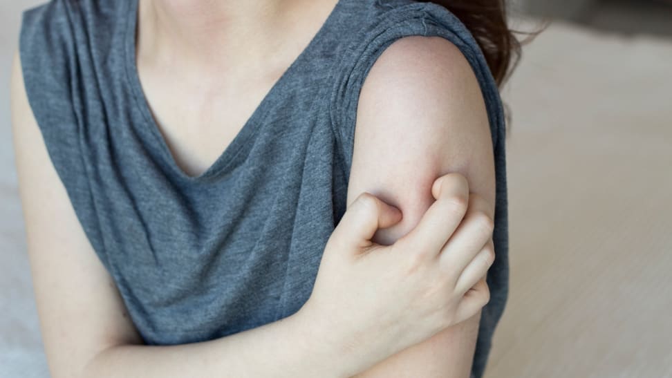 What is keratosis pilaris and what can you do for it?