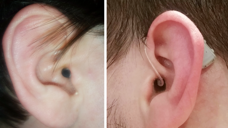 A side by side image of the in-canal Eargo 7 and behind-the-ear Lexie B2 hearing aids in our tester's ear