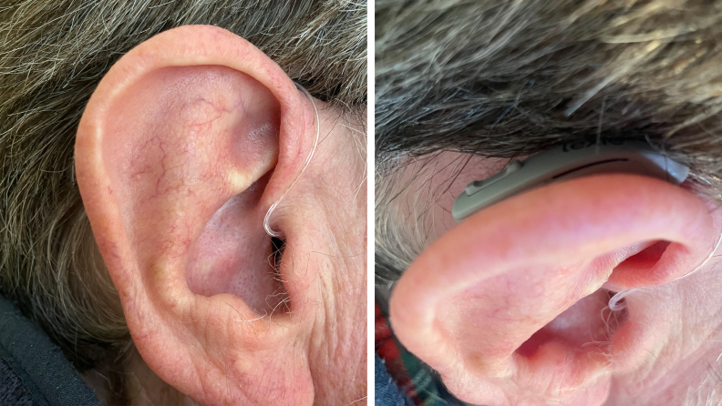 Side by side photos of the Lexie B2 plus hearing aids in a tester's ears.